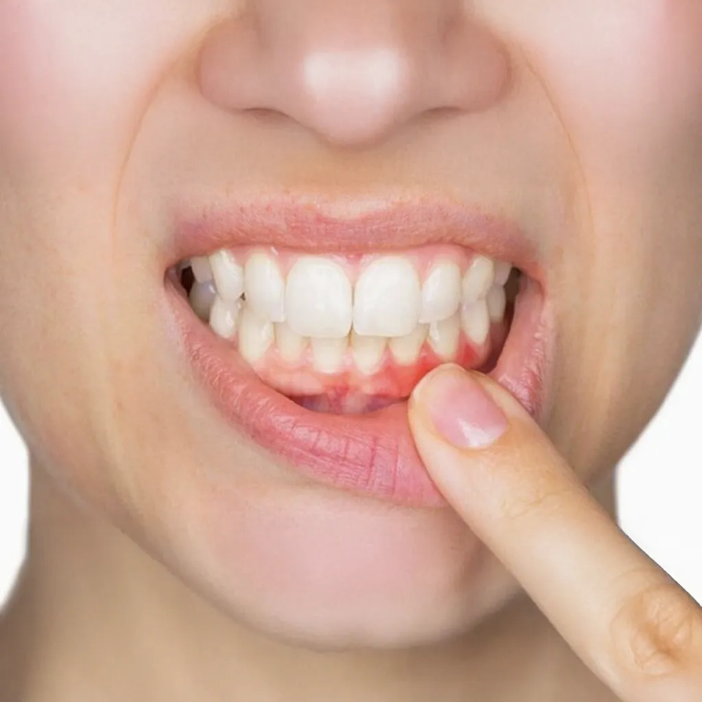 Periodontal Treatments